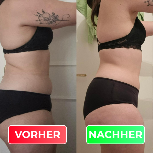 Vorher-Nachher-Vergleich