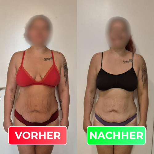 Vorher-Nachher-Vergleich