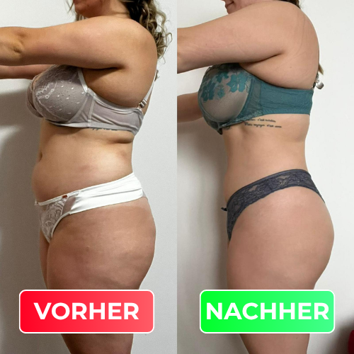 Vorher-Nachher-Vergleich
