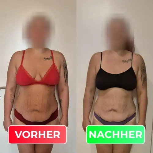 Vorher-Nachher-Vergleich