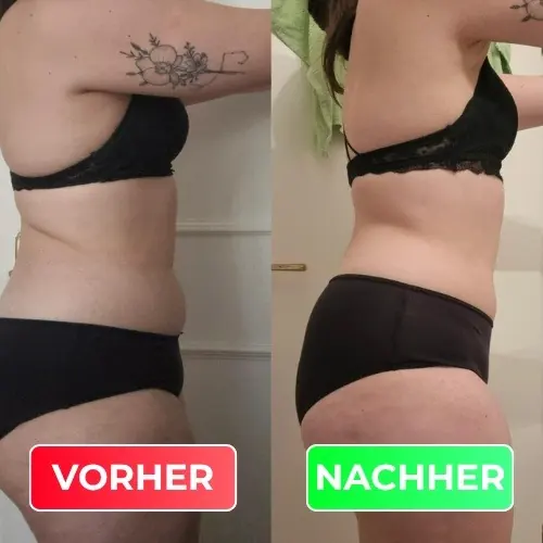 Vorher-Nachher-Vergleich