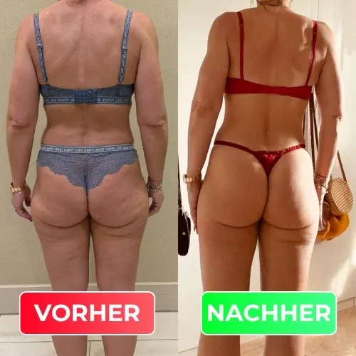 Vorher-Nachher-Vergleich