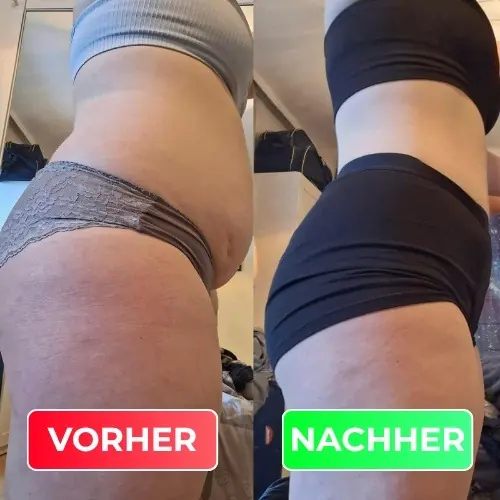 Vorher-Nachher-Vergleich